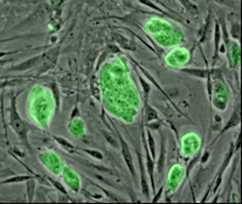 Conservación células madre del cordón umbilical
