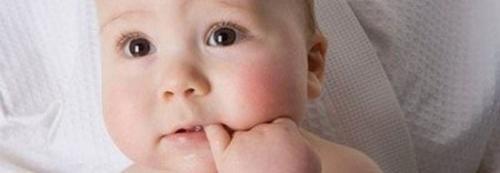 El acné en los bebés