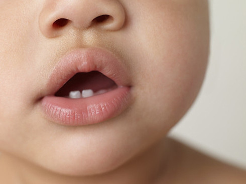 Errores de los padres en el cuidado de los dientes de sus hijos