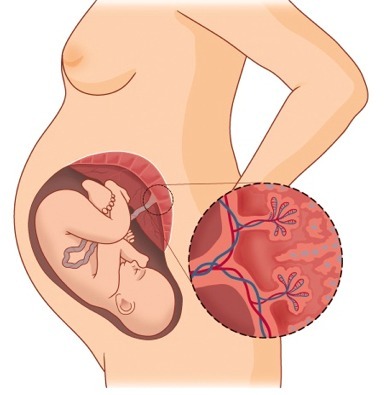 ¿Qué es la Terapia de la placenta?